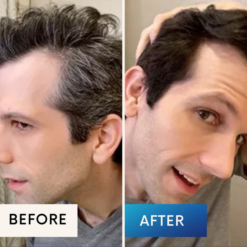NovaHair™ — Voor en na